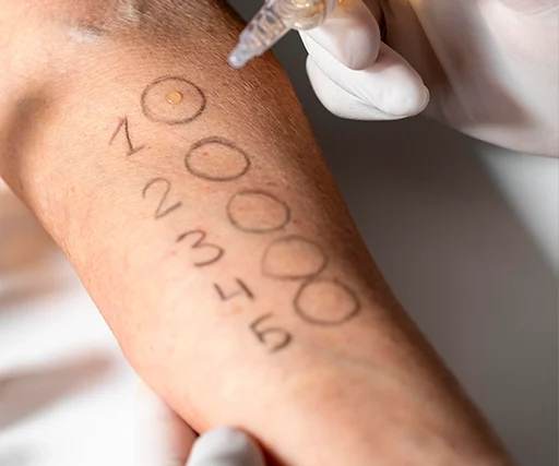 Tattoo & Freckle Removal